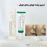 سرم ضدلک اکسیس وای