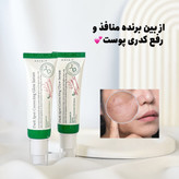 سرم ضدلک اکسیس وای